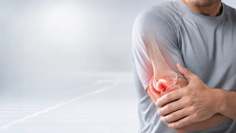 Bursitis