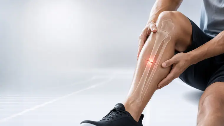 Tratamiento de Fracturas