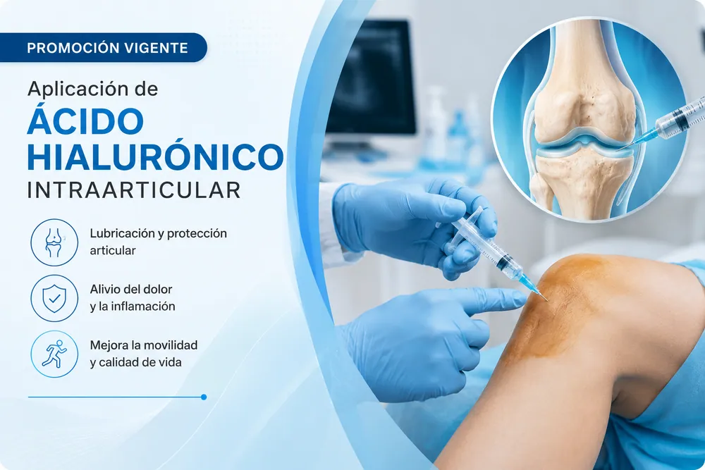 Promoción de aplicación de ácido hialurónico intraarticular en Clínica Innovo